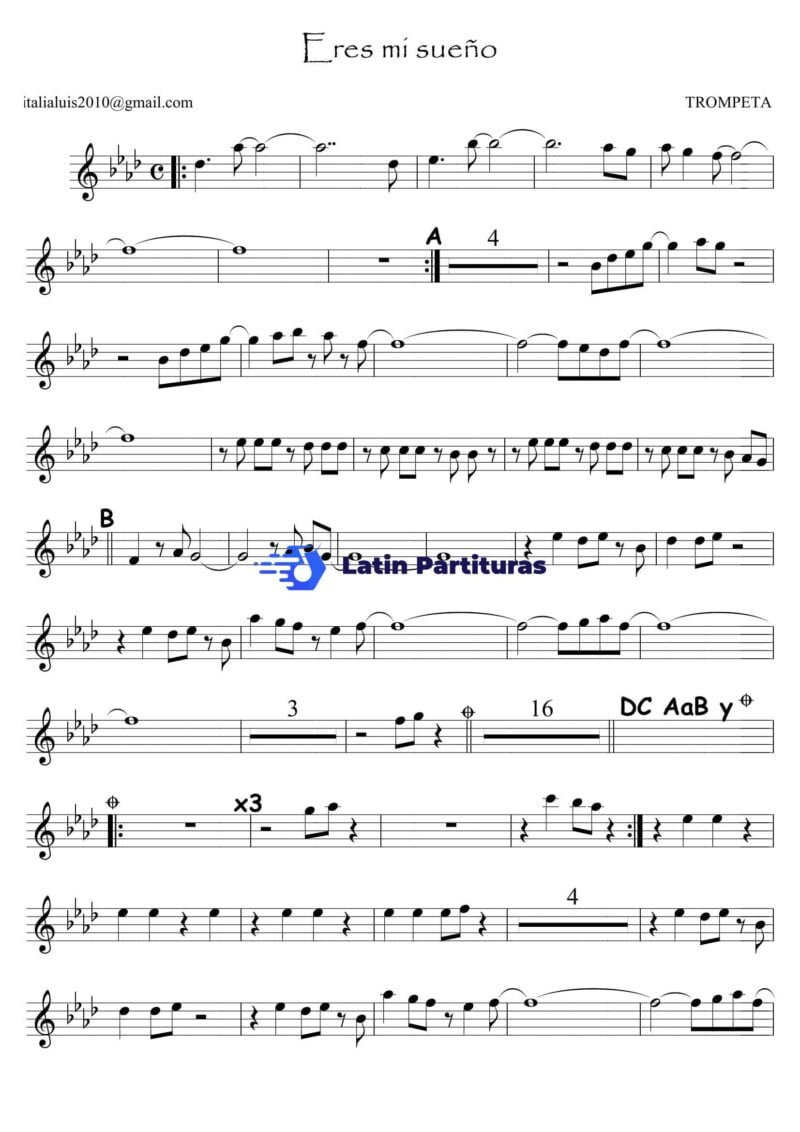 Septeto Acarey - Eres Mi Sueño (Trompeta)