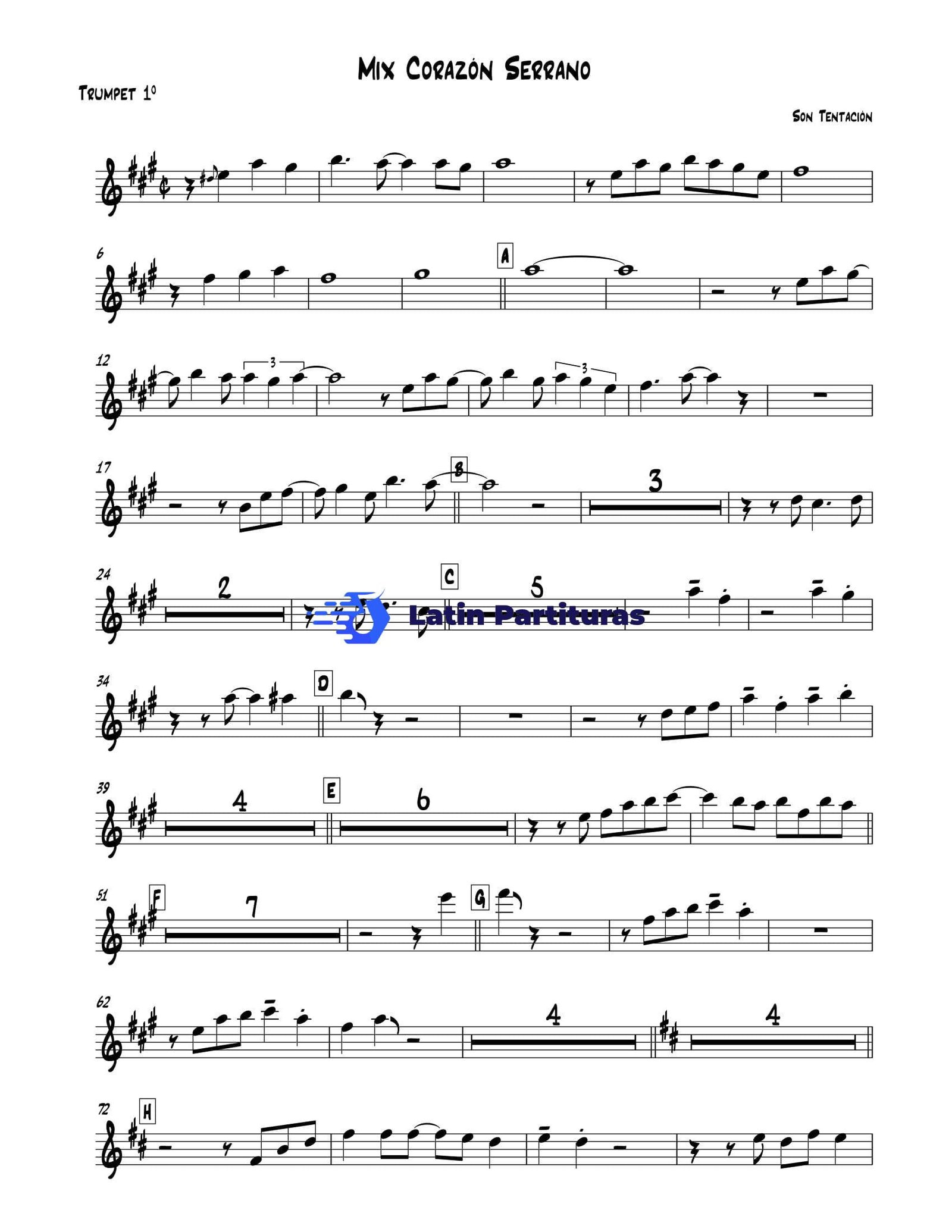 Son Tentacion - Mix Corazon Serrano 1 Son Tentacion - Mix Corazon Serrano