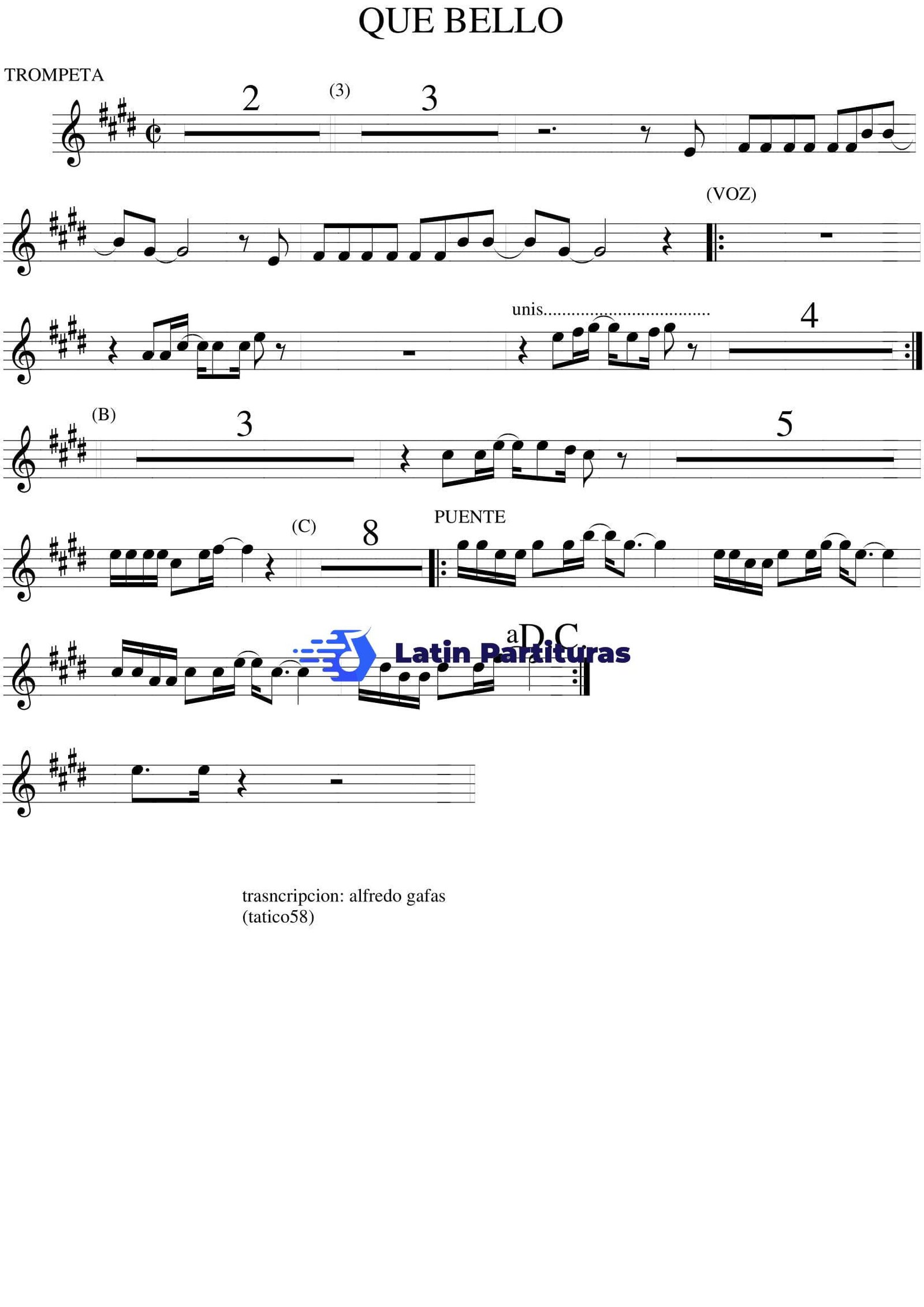 Sonora Dinamita - Que Bello 1 Sonora Dinamita - Que Bello